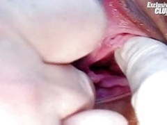 KiloPantyhose presents: Teen brunette hairy pussy gyno speculum exam