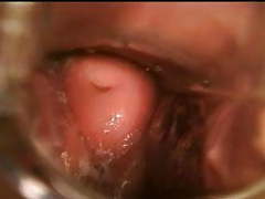 KiloPantyhose presents: Gyno speculum exam